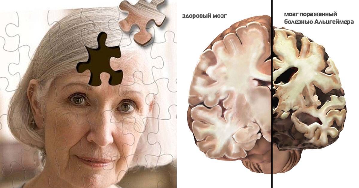 10 признаков того, что ваш мозг начал стареть | trental (пентоксифиллин)